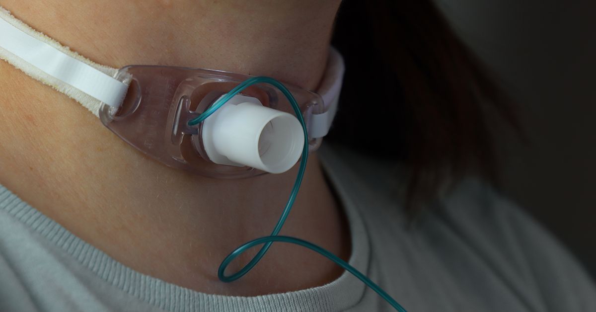 تراکئوستومی و مراقبت‌های پس از جراحی