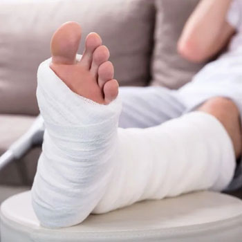 خدمات باز کردن گچ پا در منزل