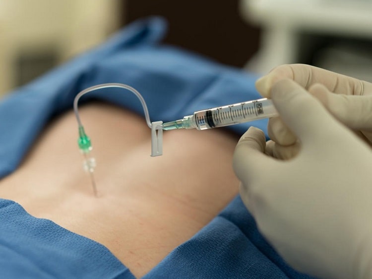 راهنمای کامل تزریق داخل نخاعی برای بیماران و پرستاران