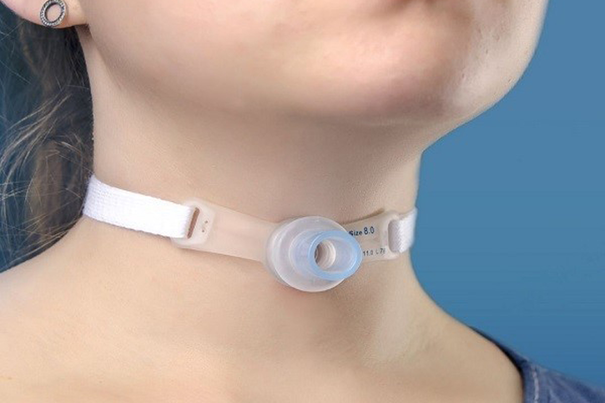 تراکئوستومی و مراقبت‌ های پس از جراحی