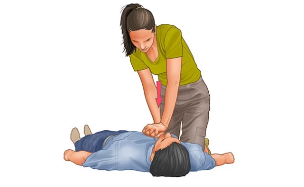 آموزش CPR و احیای قلبی‑ریوی (CPR) با کمک تیم ویزیت در خانه
