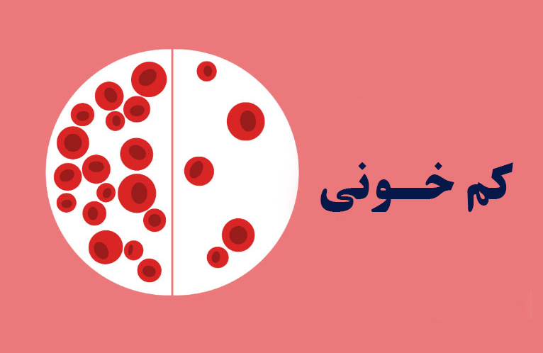 روش های درمان کم‌ خونی و فقر آهن